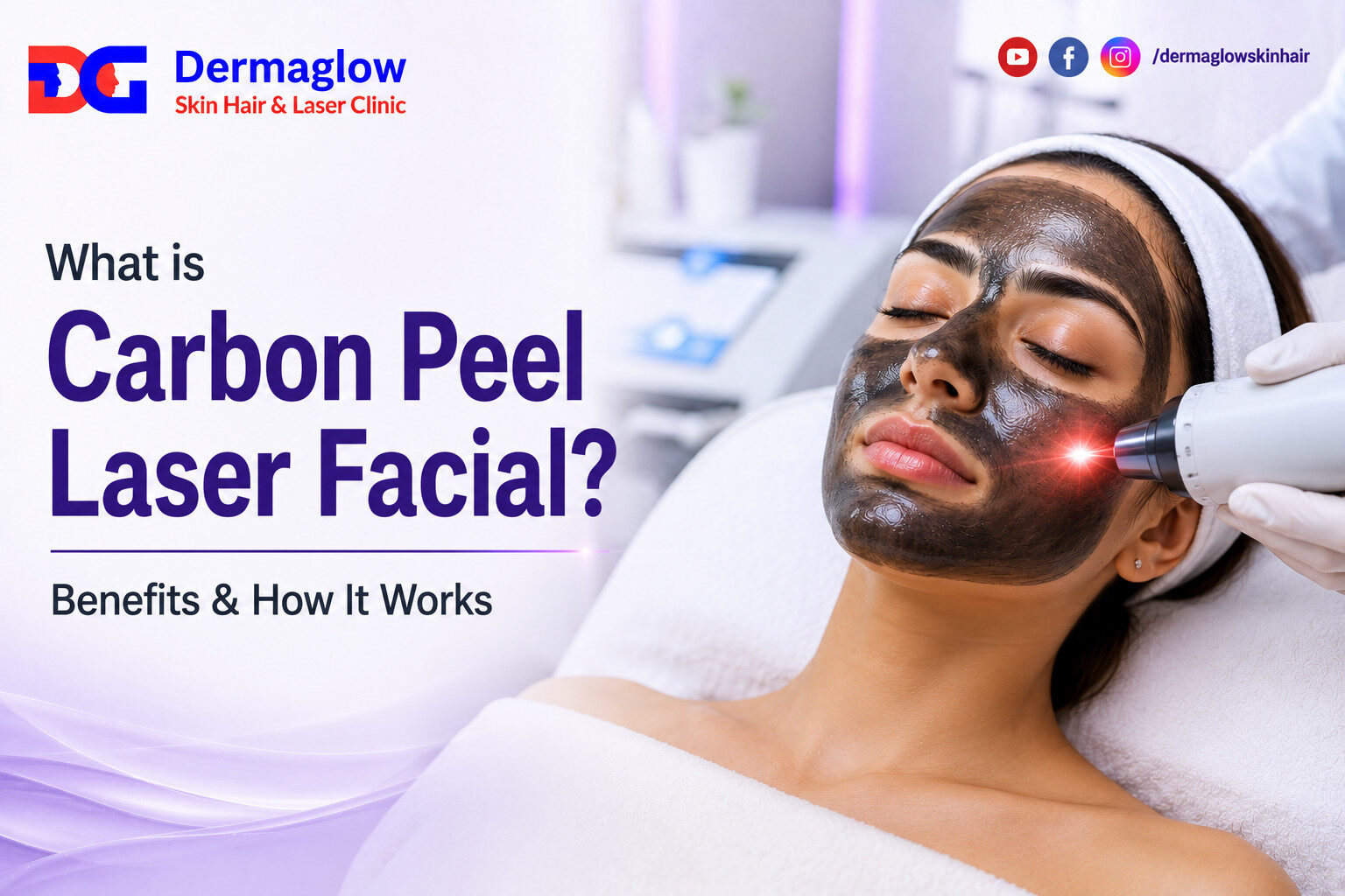Read more about the article What is Carbon Peel Laser Facial? Benefits & How It Works