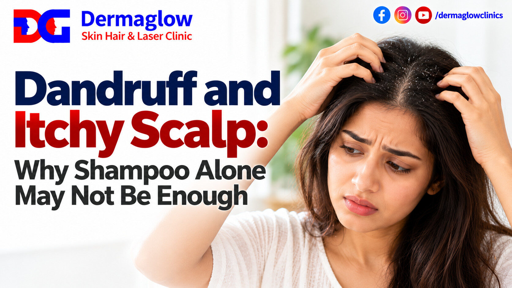 Dandruff and itchy scalp awareness by Dermaglow Skin Hair & Laser Clinic, featuring a woman examining white flakes in her hair and highlighting why shampoo alone may not be enough to manage scalp problems.