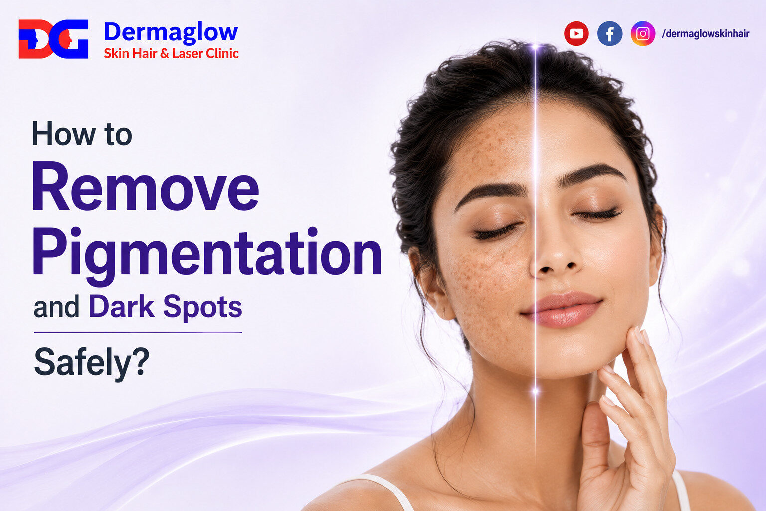 You are currently viewing How to Remove Pigmentation and Dark Spots Safely?