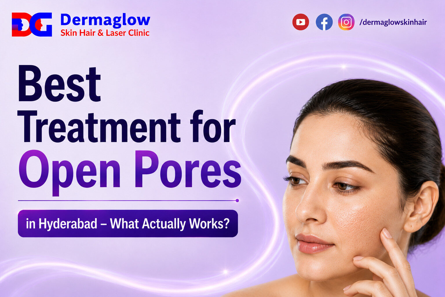 You are currently viewing Best Treatment for Open Pores in Hyderabad – What Actually Works?
