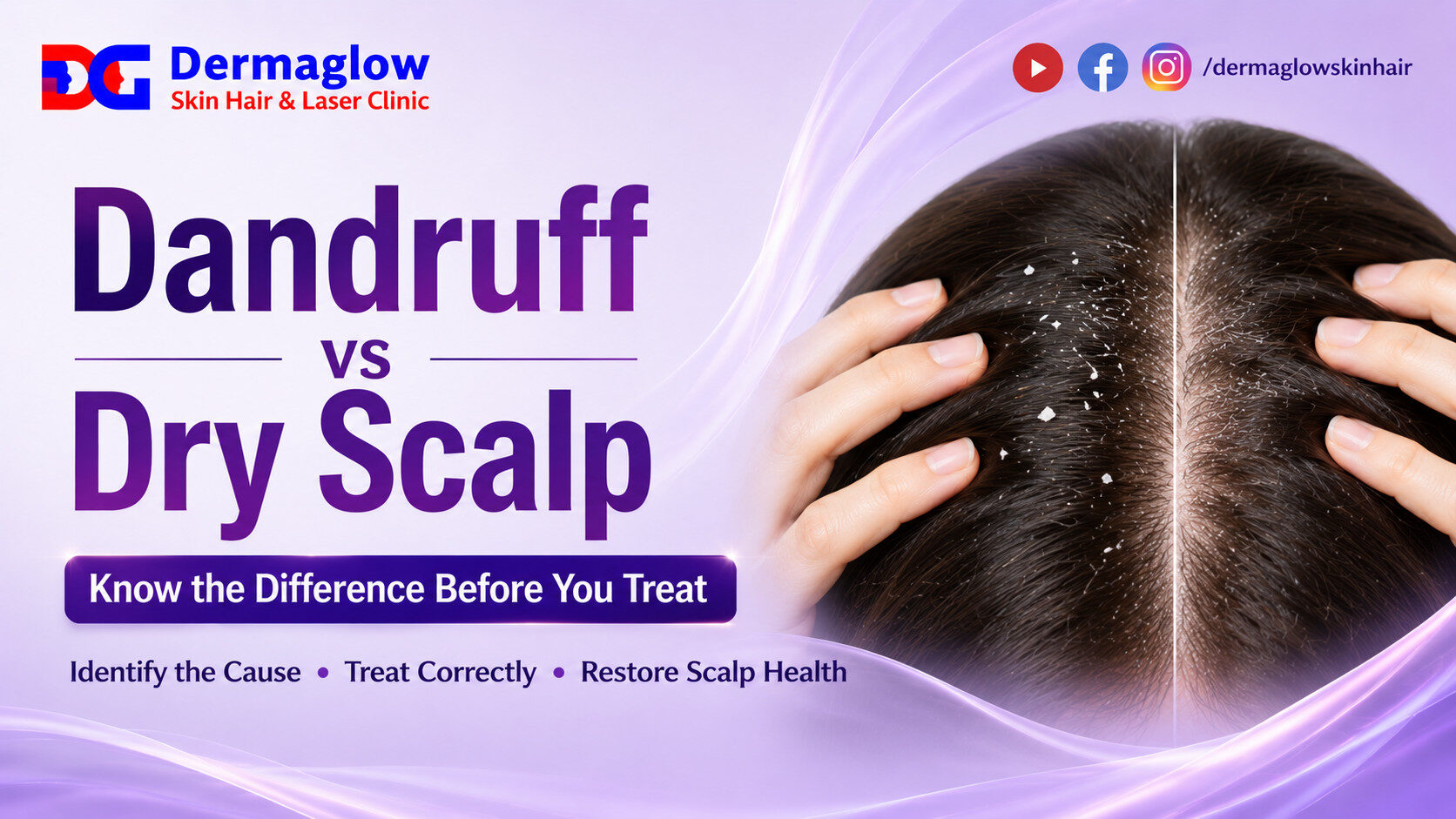 Read more about the article Dandruff vs Dry Scalp – Know the Difference Before You Treat