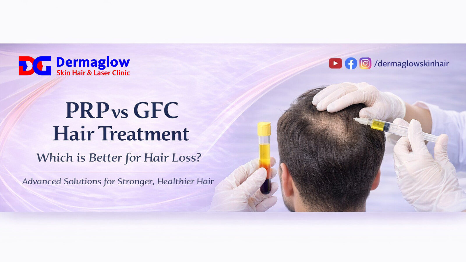 Read more about the article PRP vs GFC Hair Treatment – Which is Best for Hair Loss?