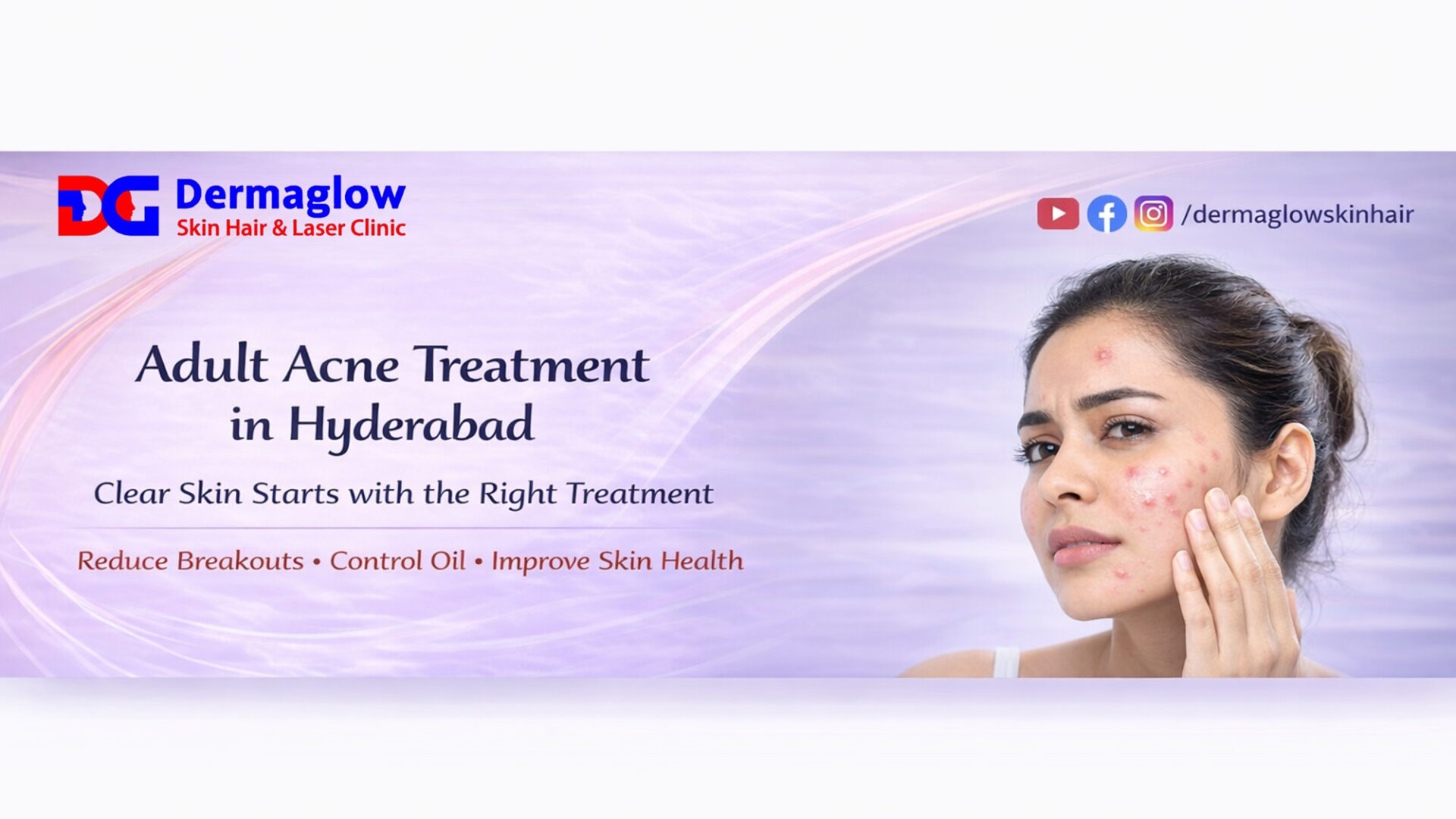 Adult acne treatment in Hyderabad at DermaGlow Skin Hair & Laser Clinic showing effective solutions for pimples, breakouts, and clear skin