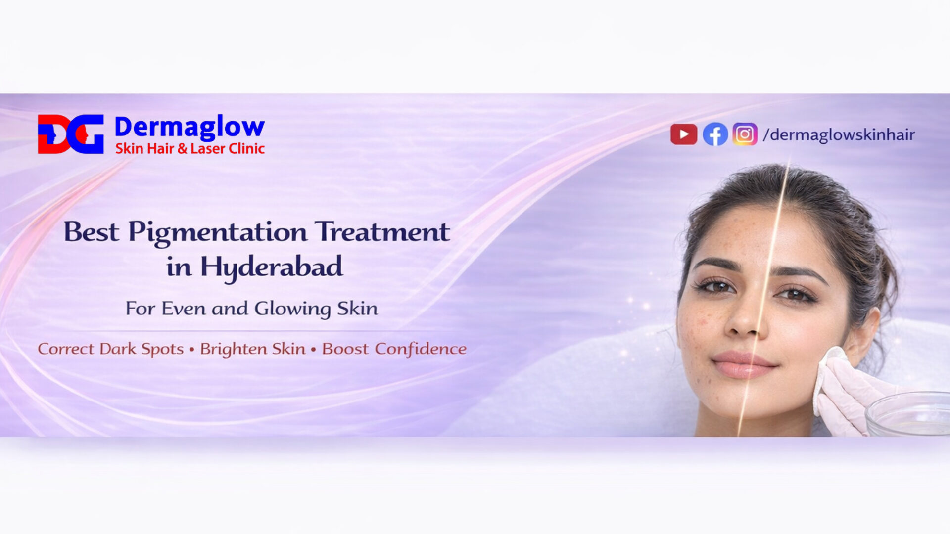 You are currently viewing Pigmentation Treatment in Hyderabad: Causes, Types & Best Solutions