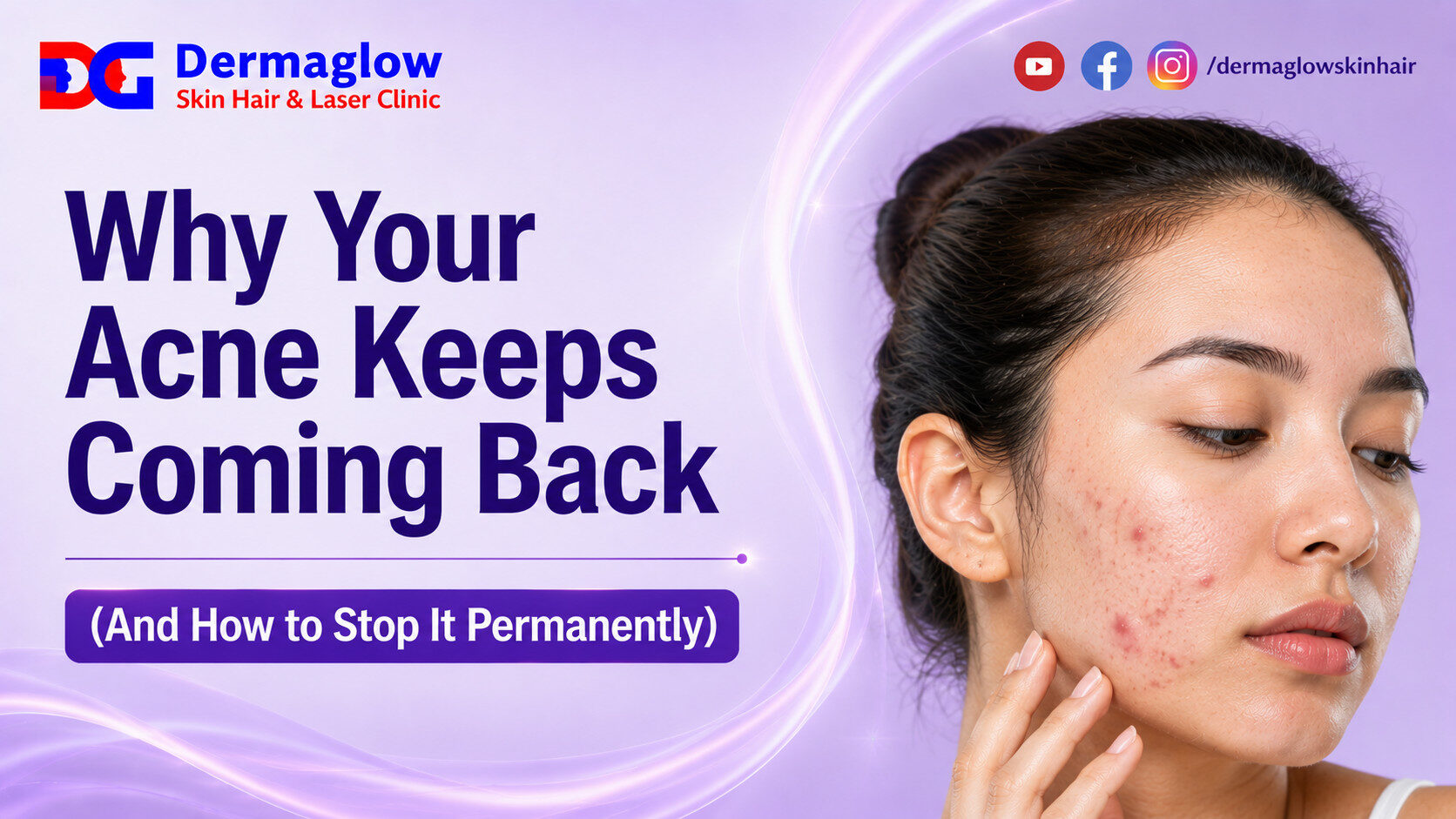 Read more about the article  Why Your Acne Keeps Coming Back (And How to Stop It Permanently)